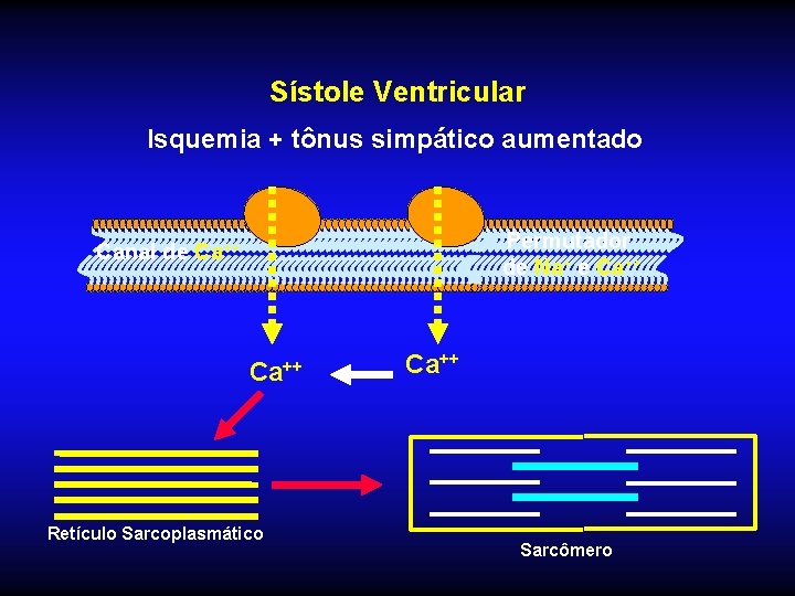 Sístole Ventricular Isquemia + tônus simpático aumentado Permutador de Na+ e Ca++ Canal de