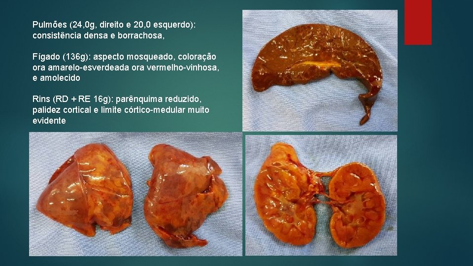 Pulmões (24, 0 g, direito e 20, 0 esquerdo): consistência densa e borrachosa, Fígado