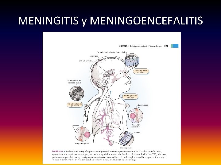 MENINGITIS y MENINGOENCEFALITIS 