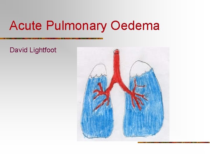 Acute Pulmonary Oedema David Lightfoot 