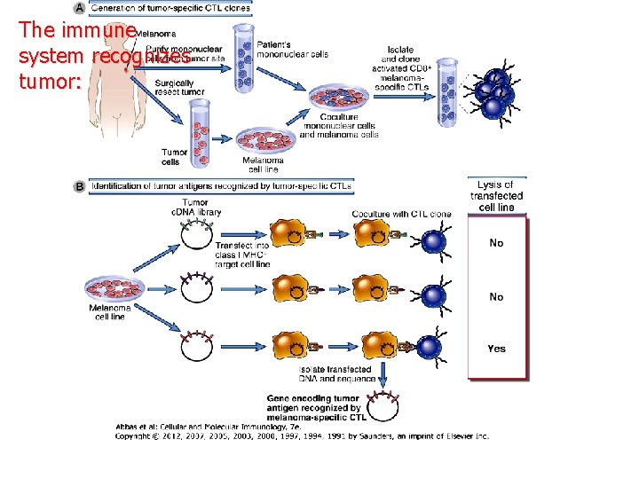 The immune system recognizes tumor: 