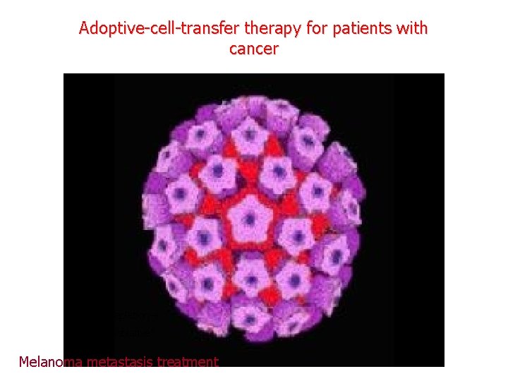 Adoptive-cell-transfer therapy for patients with cancer Limfocita depletion ”non-myeloablative” Melanoma metastasis treatment 