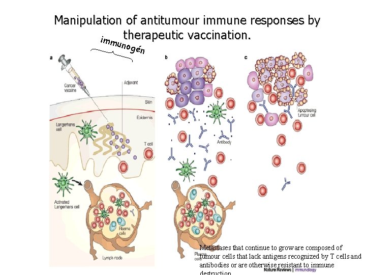 Manipulation of antitumour immune responses by imm therapeutic vaccination. unog én Metastases that continue