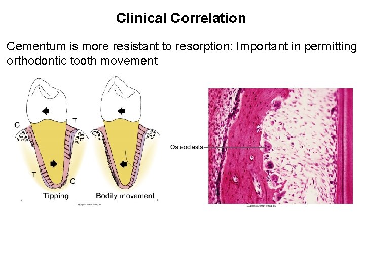 Clinical Correlation Cementum is more resistant to resorption: Important in permitting orthodontic tooth movement Clinical Correlation Cementum is more resistant to resorption: Important in permitting orthodontic tooth movement