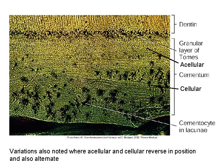 Acellular Cellular Variations also noted where acellular and cellular reverse in position and also Acellular Cellular Variations also noted where acellular and cellular reverse in position and also