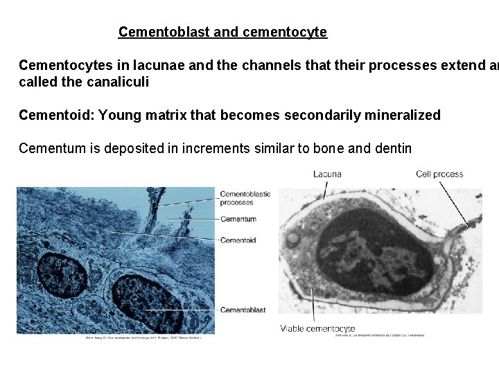 Cementoblast and cementocyte Cementocytes in lacunae and the channels that their processes extend ar Cementoblast and cementocyte Cementocytes in lacunae and the channels that their processes extend ar