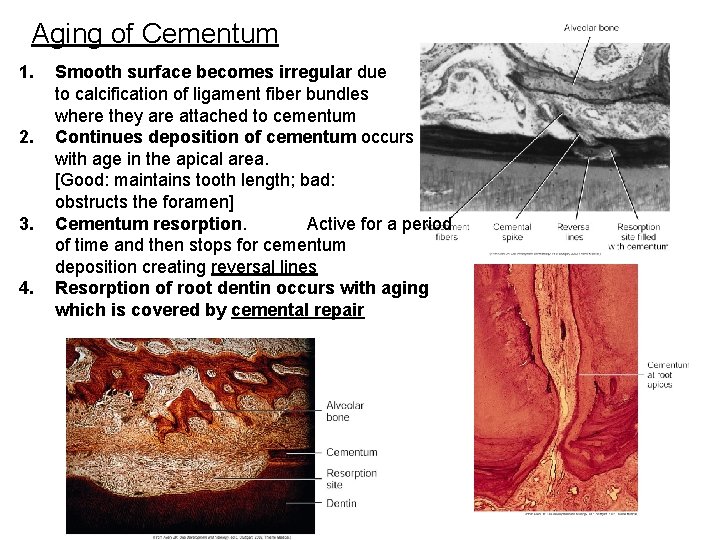 Aging of Cementum 1. 2. 3. 4. Smooth surface becomes irregular due to calcification Aging of Cementum 1. 2. 3. 4. Smooth surface becomes irregular due to calcification