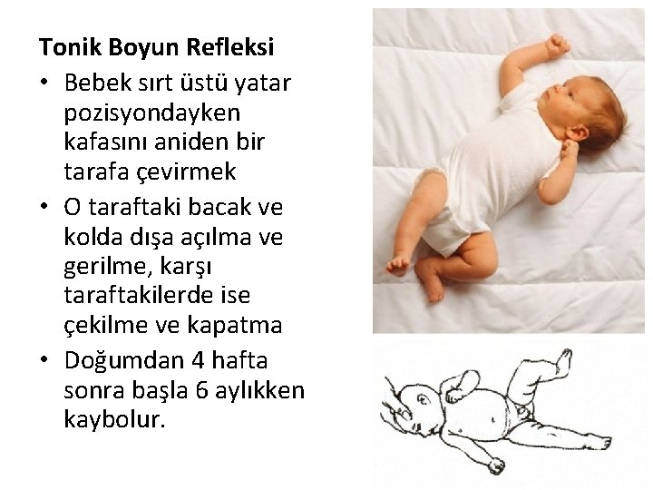Tonik Boyun Refleksi • Bebek sırt üstü yatar pozisyondayken kafasını aniden bir tarafa çevirmek