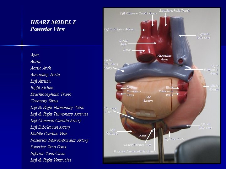 Left Common Carotid Artery HEART MODEL I Posterior View Brachiocephalic Trunk Left Subclavian Artery
