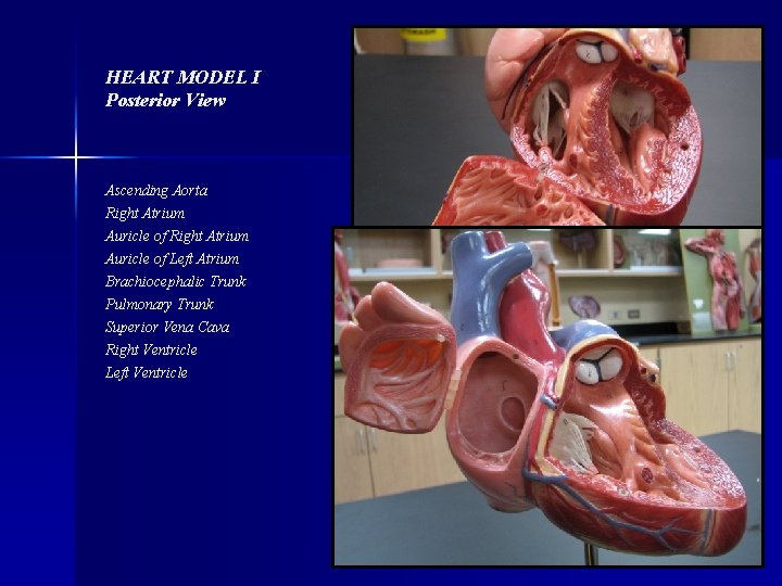 HEART MODEL I Posterior View Ascending Aorta Right Atrium Auricle of Left Atrium Brachiocephalic