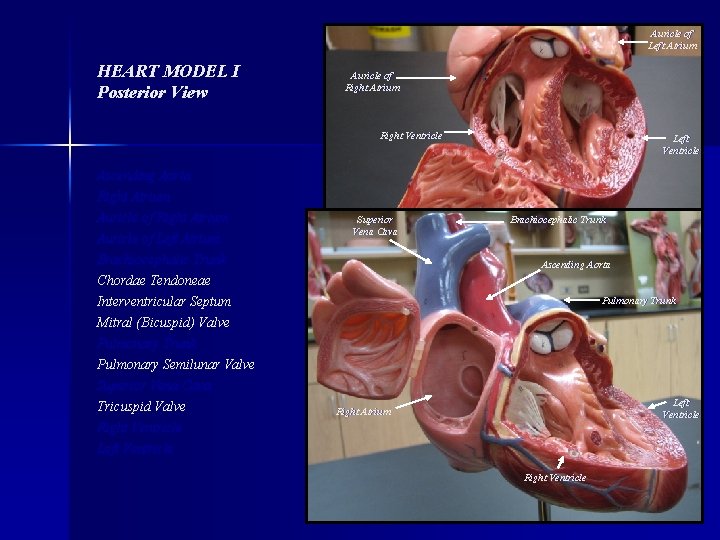 Auricle of Left Atrium HEART MODEL I Posterior View Auricle of Right Atrium Right