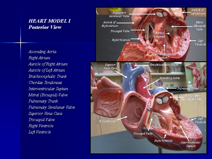 Auricle of Left Atrium Pulmonary Semilunar Valve HEART MODEL I Posterior View Auricle of