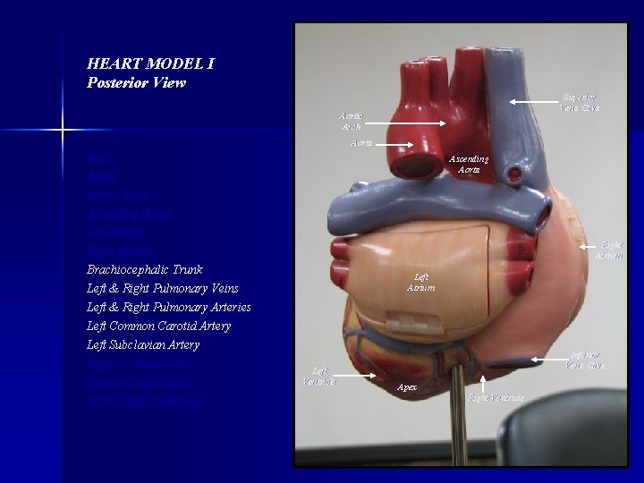 HEART MODEL I Posterior View Superior Vena Cava Aortic Arch Aorta Apex Aorta Ascending