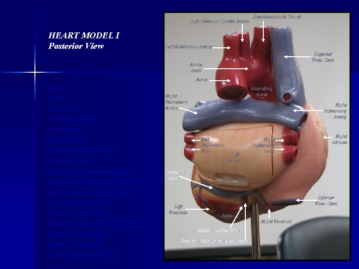 Left Common Carotid Artery HEART MODEL I Posterior View Brachiocephalic Trunk Left Subclavian Artery