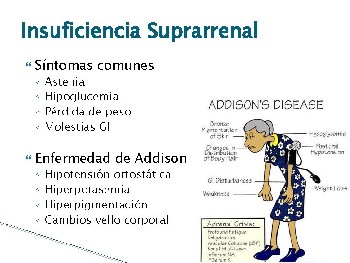 Insuficiencia Suprarrenal Síntomas comunes ◦ ◦ Astenia Hipoglucemia Pérdida de peso Molestias GI Enfermedad