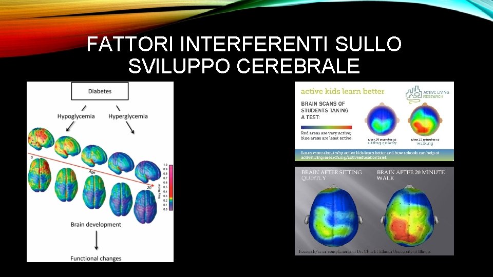 FATTORI INTERFERENTI SULLO SVILUPPO CEREBRALE 