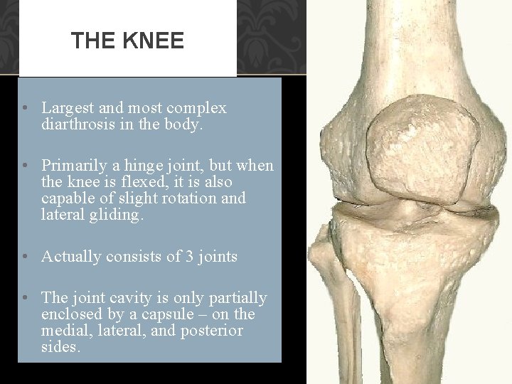 THE KNEE • Largest and most complex diarthrosis in the body. • Primarily a