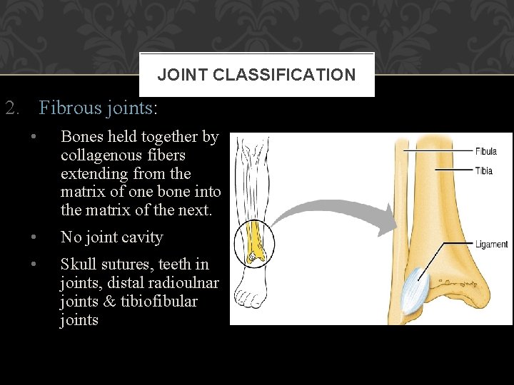 JOINT CLASSIFICATION 2. Fibrous joints: • Bones held together by collagenous fibers extending from