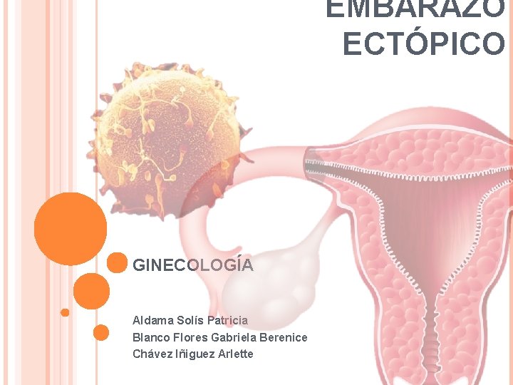 EMBARAZO ECTÓPICO GINECOLOGÍA Aldama Solís Patricia Blanco Flores Gabriela Berenice Chávez Iñiguez Arlette 