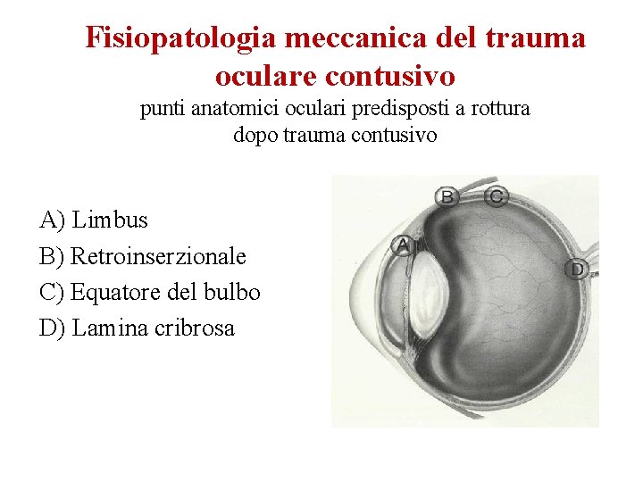 Fisiopatologia meccanica del trauma oculare contusivo punti anatomici oculari predisposti a rottura dopo trauma