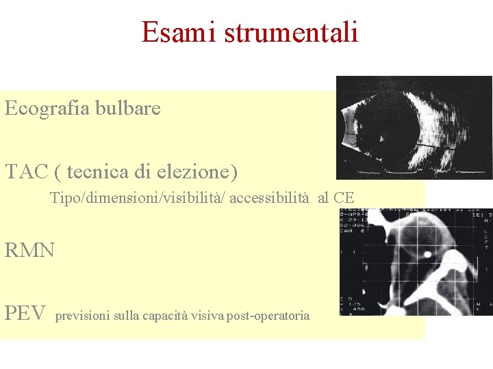 Esami strumentali Ecografia bulbare TAC ( tecnica di elezione) Tipo/dimensioni/visibilità/ accessibilità al CE RMN