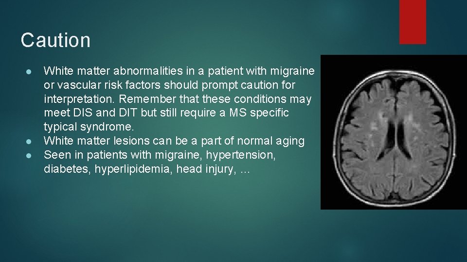 Caution ● ● ● White matter abnormalities in a patient with migraine or vascular