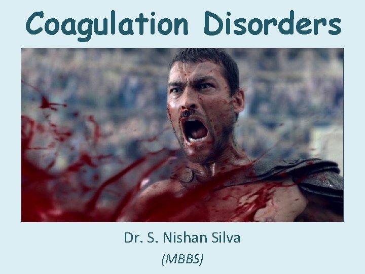 Coagulation Disorders Dr. S. Nishan Silva (MBBS) 