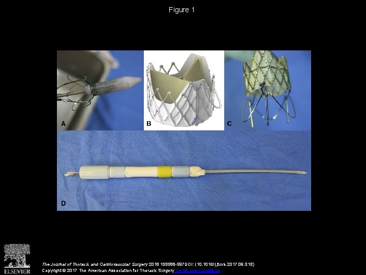 Figure 1 The Journal of Thoracic and Cardiovascular Surgery 2018 155588 -597 DOI: (10.