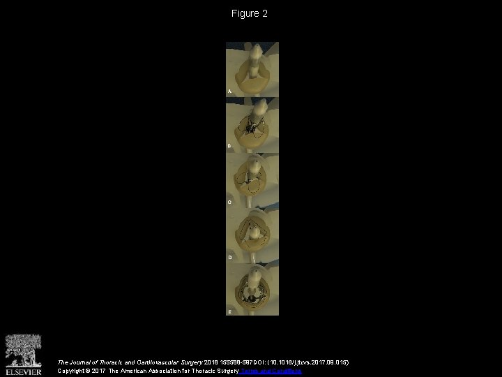 Figure 2 The Journal of Thoracic and Cardiovascular Surgery 2018 155588 -597 DOI: (10.