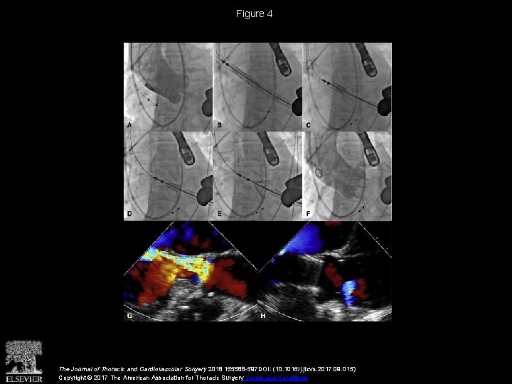 Figure 4 The Journal of Thoracic and Cardiovascular Surgery 2018 155588 -597 DOI: (10.