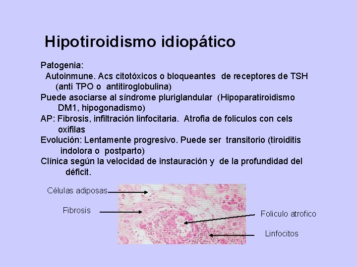 Hipotiroidismo idiopático Patogenia: Autoinmune. Acs citotóxicos o bloqueantes de receptores de TSH (anti TPO