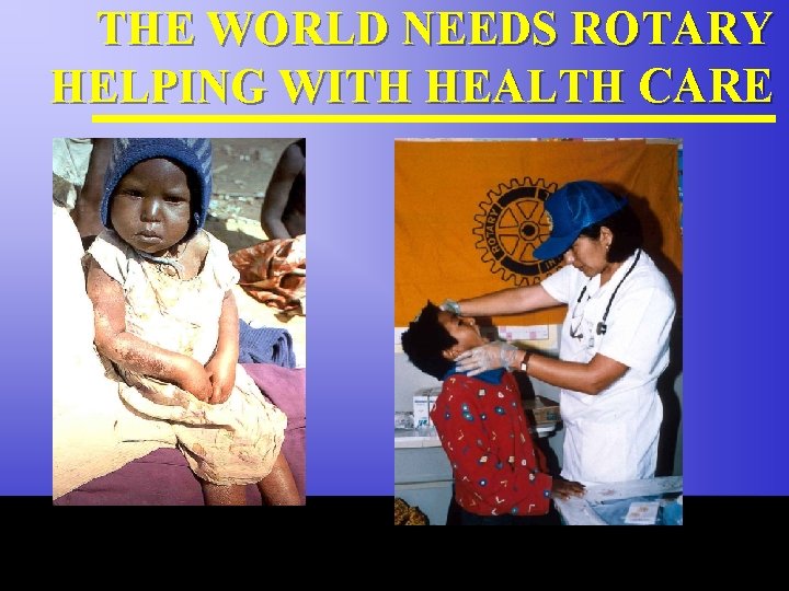 THE WORLD NEEDS ROTARY HELPING WITH HEALTH CARE The Rotary Foundation of Rotary International