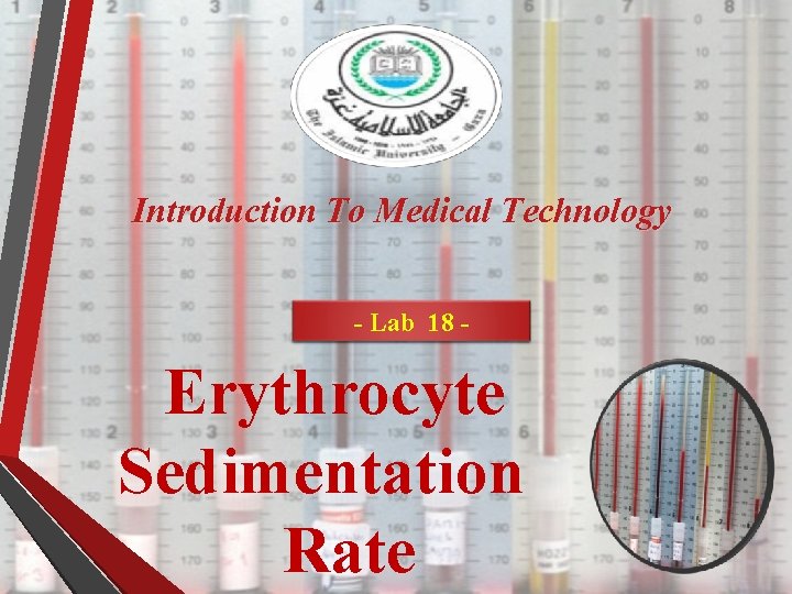 (ESR) Introduction To Medical Technology - Lab 18 - Erythrocyte Sedimentation Rate 