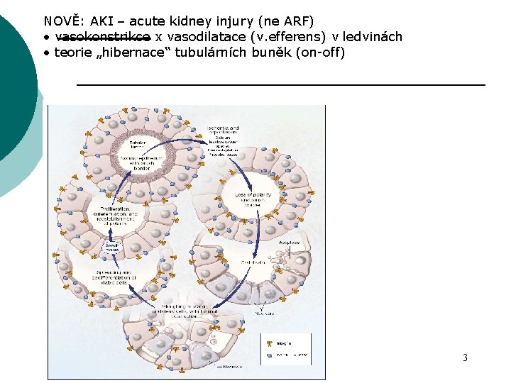 NOVĚ: AKI – acute kidney injury (ne ARF) • vasokonstrikce x vasodilatace (v. efferens)