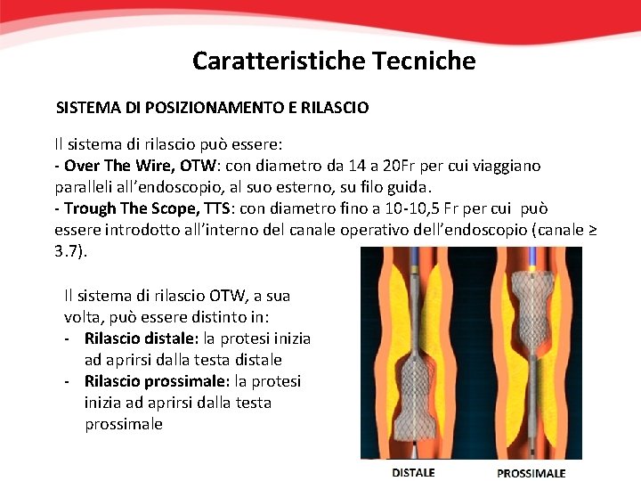 Caratteristiche Tecniche SISTEMA DI POSIZIONAMENTO E RILASCIO Il sistema di rilascio può essere: -