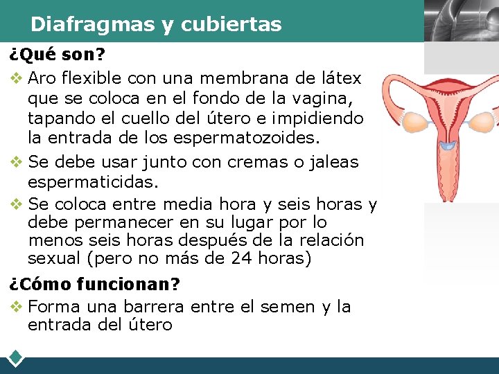 Diafragmas y cubiertas ¿Qué son? v Aro flexible con una membrana de látex que