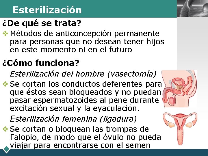 Esterilización ¿De qué se trata? v Métodos de anticoncepción permanente para personas que no