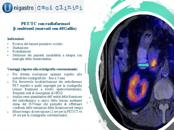 PET/TC con radiofarmaci β-emittenti (marcati con 68 Gallio) Indicazioni: • • Ricerca del tumore