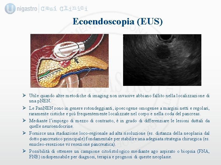 Ecoendoscopia (EUS) Ø Utile quando altre metodiche di imaging non invasive abbiano fallito nella