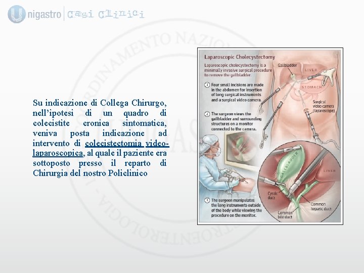 Su indicazione di Collega Chirurgo, nell’ipotesi di un quadro di colecistite cronica sintomatica, veniva