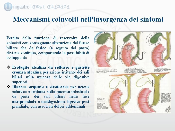 Meccanismi coinvolti nell'insorgenza dei sintomi Perdita della funzione di reservoire della colecisti conseguente alterazione