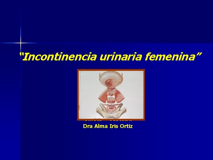 “Incontinencia urinaria femenina” Gíneco – Obstetra Dra Alma Iris Ortiz 