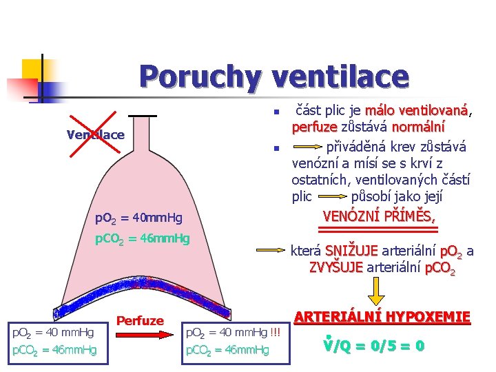 Poruchy ventilace n Ventilace n p. O 2 = 40 mm. Hg p. CO