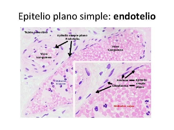 Epitelio plano simple: endotelio 