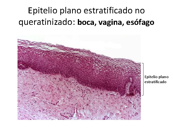 Epitelio plano estratificado no queratinizado: boca, vagina, esófago Epitelio plano estratificado 