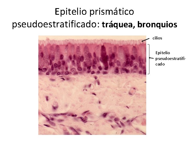 Epitelio prismático pseudoestratificado: tráquea, bronquios cilios Epitelio pseudoestratificado 