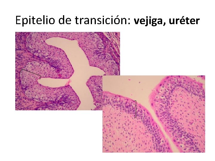 Epitelio de transición: vejiga, uréter 