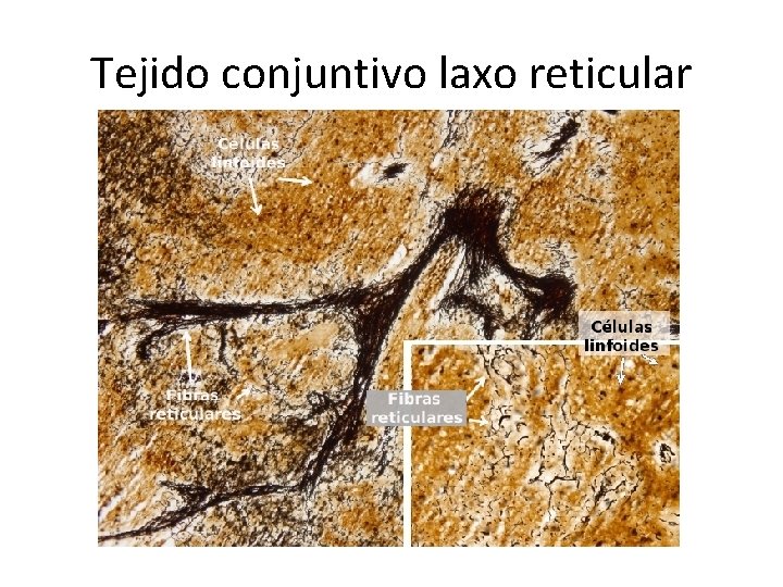 Tejido conjuntivo laxo reticular 