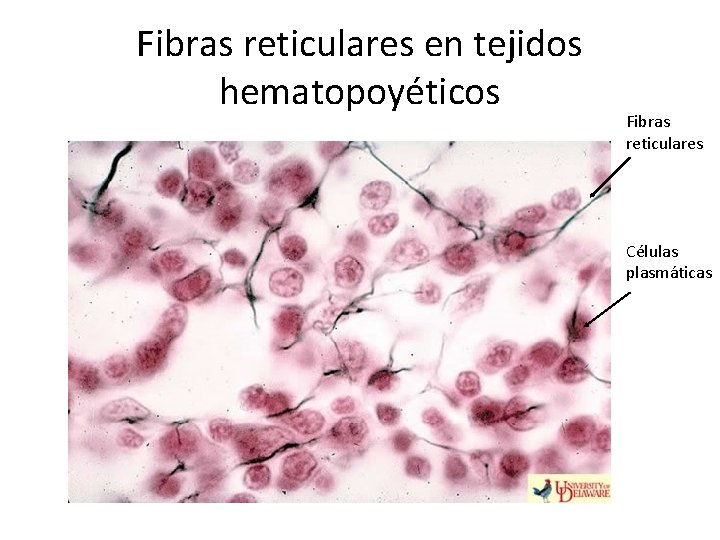 Fibras reticulares en tejidos hematopoyéticos Fibras reticulares Células plasmáticas 