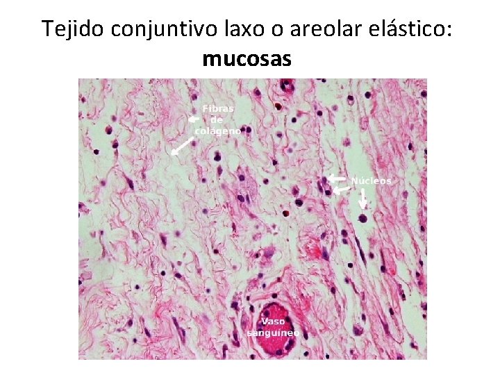 Tejido conjuntivo laxo o areolar elástico: mucosas 